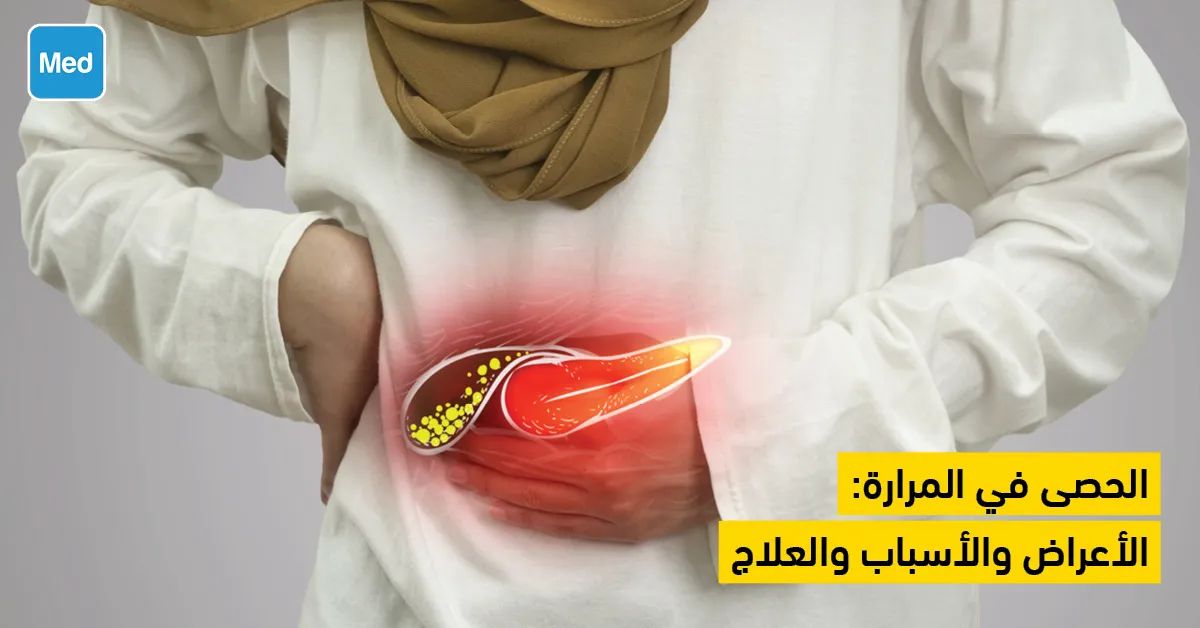 الحصى في المرارة : الأعراض والأسباب والعلاج